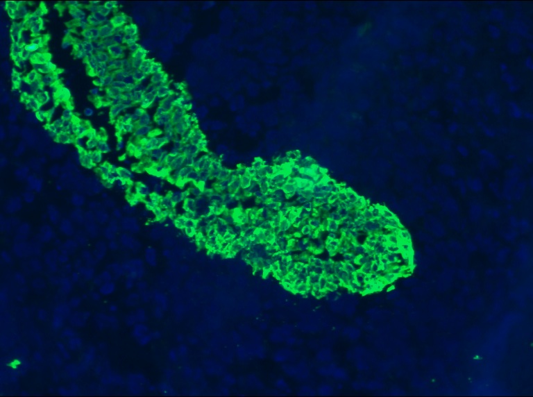 Figure 1. Indirect immunofluorescence staining of a frozen section of human urinary bladder using MUB0314P (clone RCK102) at a 1:200x dilution. Note strong staining of urothelium and no reactivity in the connective tissue or muscle tissue.